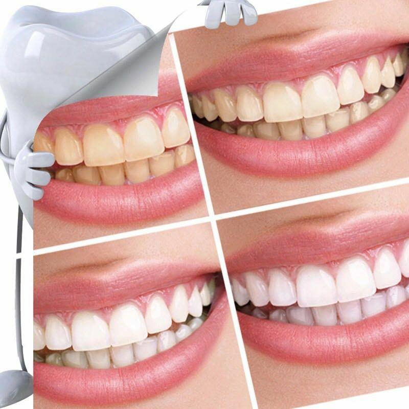 أداة تبييض الأسنان أداة تبييض الأسنان العناية الشخصية أداة تبييض الأسنان أداة تبييض الأسنان العناية الشخصية
