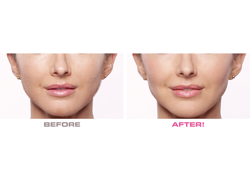 Flawless Dermaplane Glo-جهاز تقشير وإزالة شعر الوجه Flawless Dermaplane Glo-جهاز تقشير وإزالة شعر الوجه Electrical Hair Removals Flawless Dermaplane Glo-جهاز تقشير وإزالة شعر الوجه Flawless Dermaplane Glo-جهاز تقشير وإزالة شعر الوجه Electrical Hair Removals