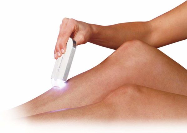 YES Hair removal device YES Hair removal device Electrical Hair Removals YES Hair removal device YES Hair removal device Electrical Hair Removals