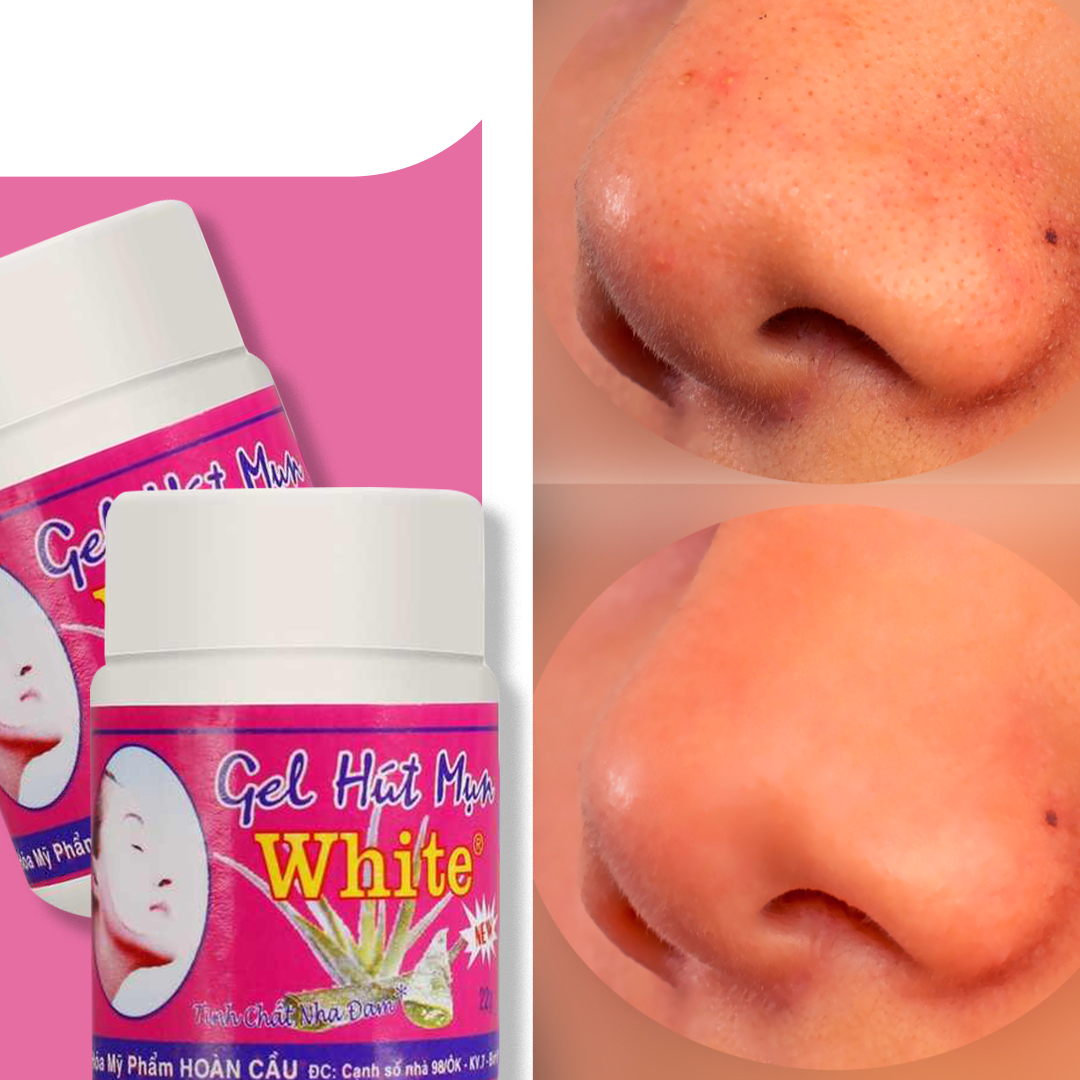 جل الرؤوس السوداء جل الرؤوس السوداء أدوات الجمال جل الرؤوس السوداء جل الرؤوس السوداء أدوات الجمال